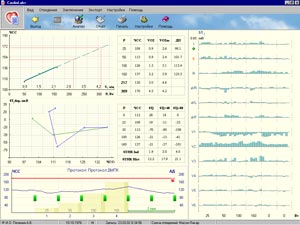 ������ ����������� ���������� (17 kb)