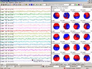 ��������� ����� ICA ��������� (29 kb)