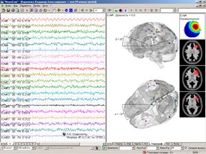 ���������� ��������� ICA ���������� (23 kb)